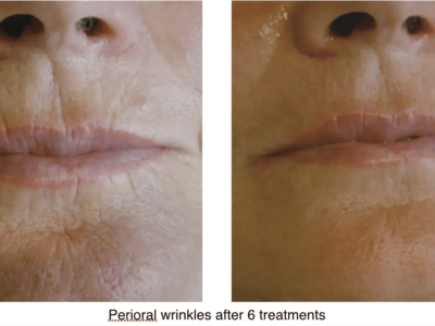 Screenshot 2025-03-04 at 3.38.01 PM-2